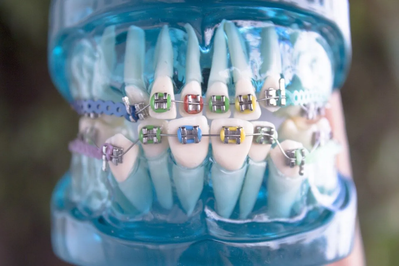 Close-up model of teeth with colorful braces