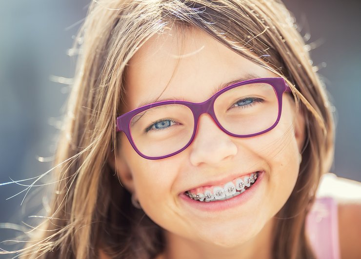 Braces